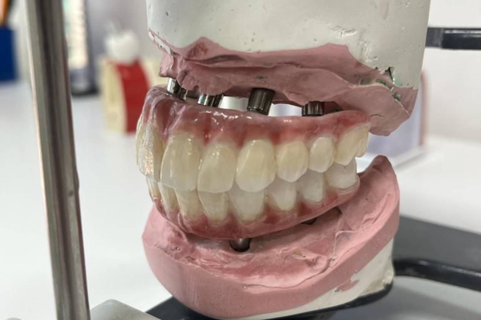 Full-Arch-Phase-2-2-min